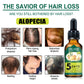 Natural Anti Hairfall Ginger Hair Growth Oil for Nourishing Hair