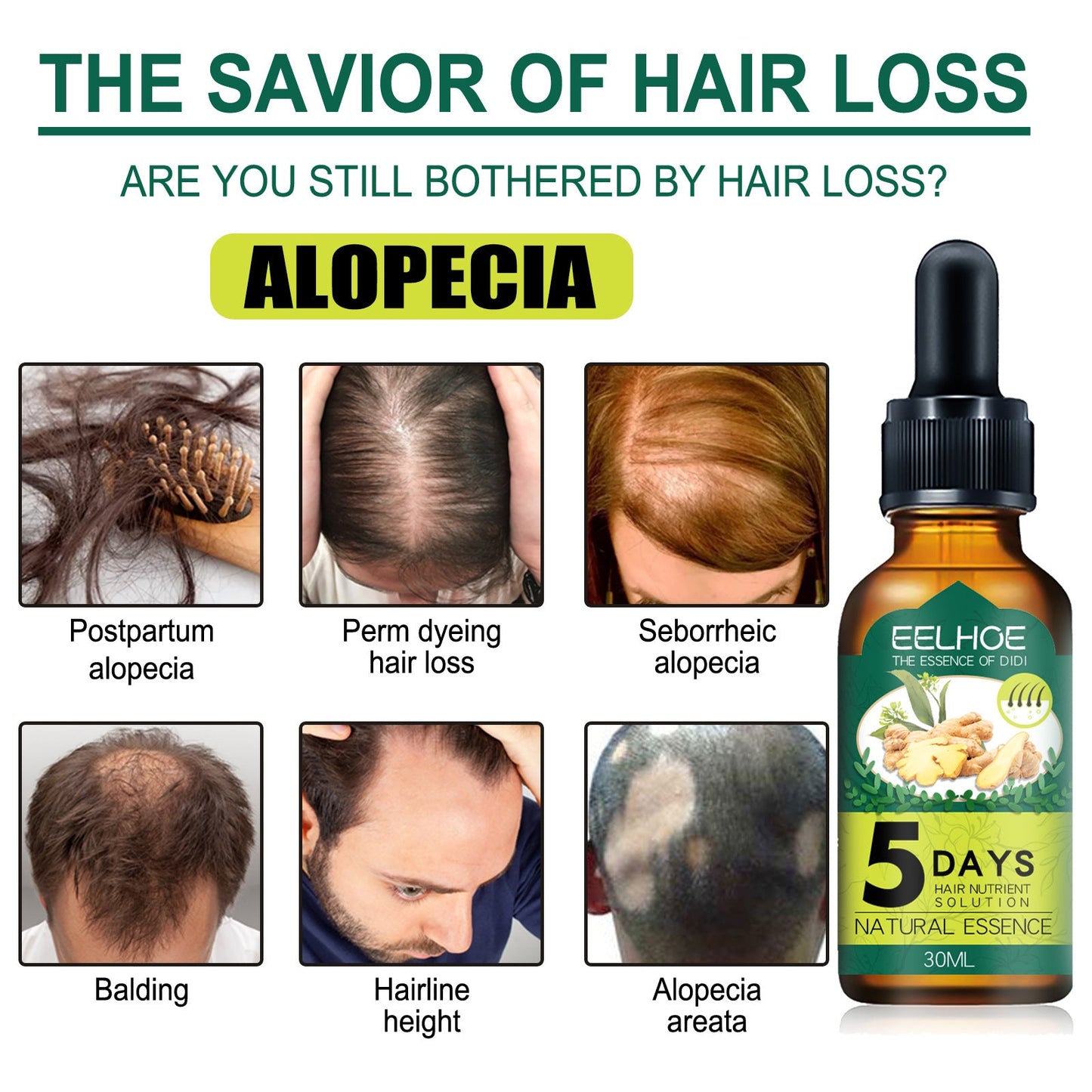 Natural Anti Hairfall Ginger Hair Growth Oil for Nourishing Hair