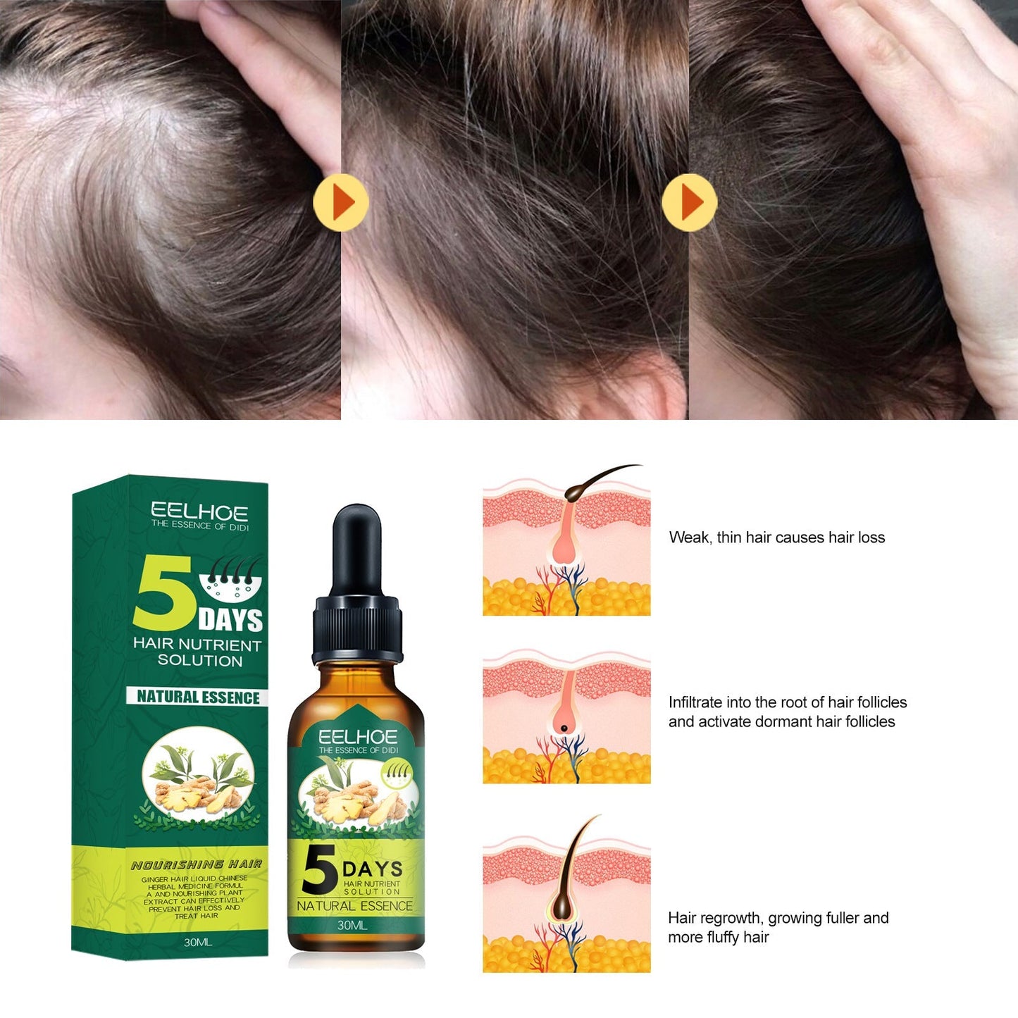 Natural Anti Hairfall Ginger Hair Growth Oil for Nourishing Hair