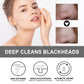 Blackheads Cream for Deep Cleansing and Excess Oil