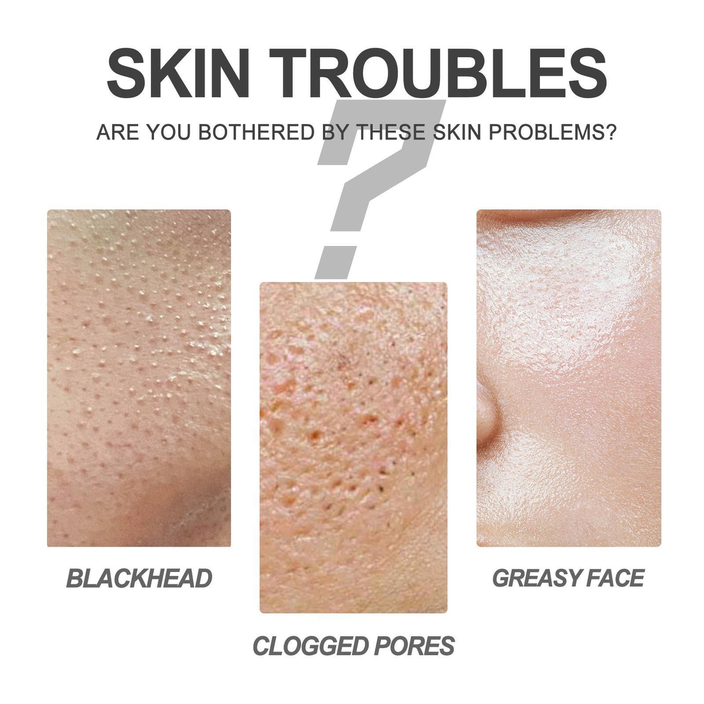 Blackheads Cream for Deep Cleansing and Excess Oil